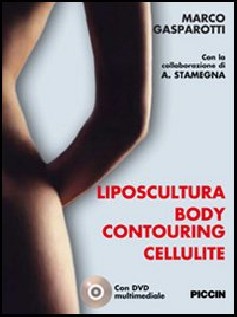 Liposcultura body contouring cellulite. Con DVD
