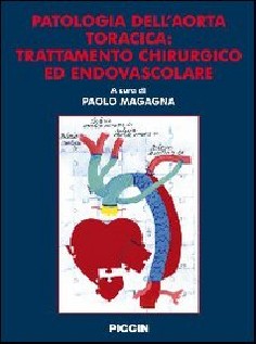Patologia dell'aorta toracica. Trattamento chirurgico ed endovascolare