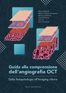 Guida alla comprensione dellangiografia OCT. Dalla fisiopatologia all'imaging clinico